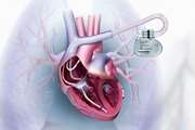 تعامل بین درمان مجدد قلبی و سیتوکین ها در بیماران نارسایی قلبی