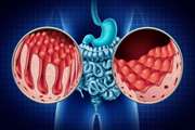 نقش رژیم بدون گلوتن بر سطح HbA1c در کودکان مبتلا به دیابت نوع ۱ و بیماری سلیاک