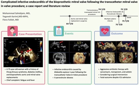  infective endocarditis {faces}