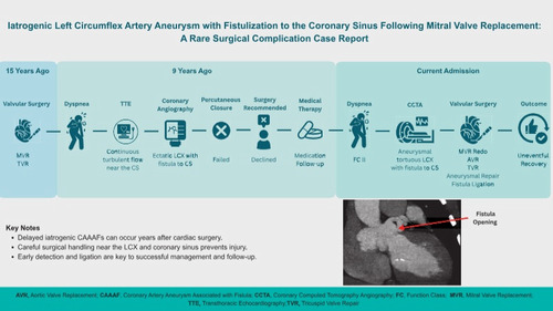 عارضه پنهان جراحی قلب: وقتی تعویض دریچه میترال، شریان قلب را ۱۵ سال بعد به دردسر می‌اندازد!